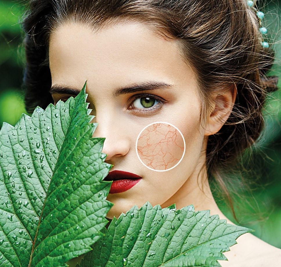 Концентрат антикуперозний REDNESS CONTROL - результат застосування